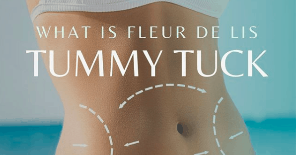 WHAT IS FLEUR DE LIS