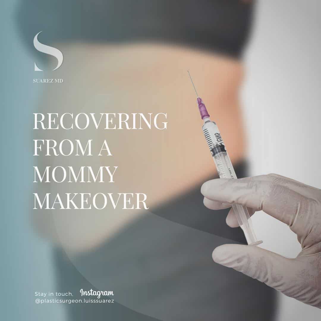 Recovering from a mommy makeover